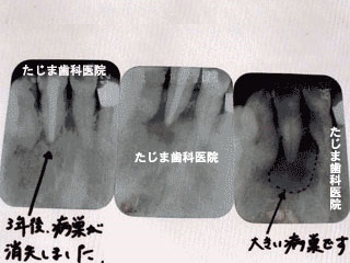 たじま歯科医院｜安中市｜一般歯科・小児歯科