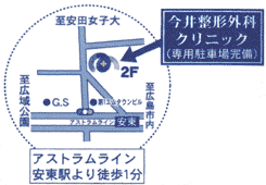 ���䐮�`�O�ȃN���j�b�N�b�L���s�������b���`�O�ȁE�L���s����������