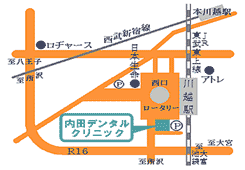 内田デンタルクリニック｜川越市｜歯科